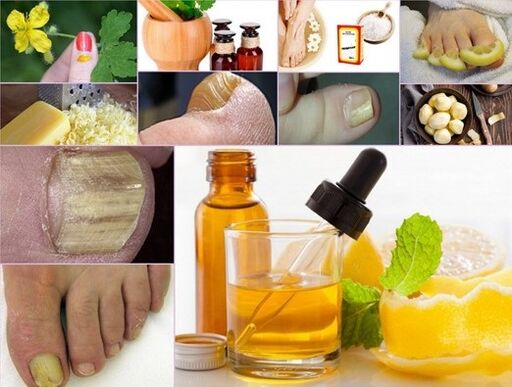 remédios populares para tratar fungos nas unhas dos pés