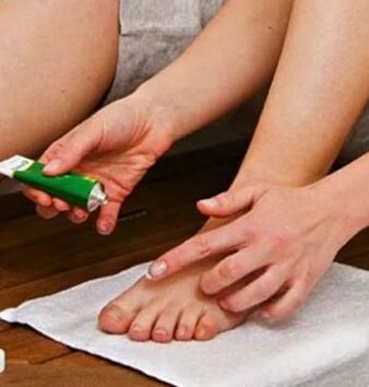 O uso de pomada terapêutica para a derrota da unha do dedão do pé com um fungo